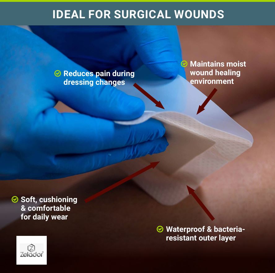 Moderex Lite Foam Dressing – Zelador