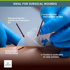 Hydraseal Hydrocolloid Extra Thin Dressing