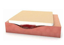 Load image into Gallery viewer, Moderex Plus Silicone Foam Absorbent Dressing